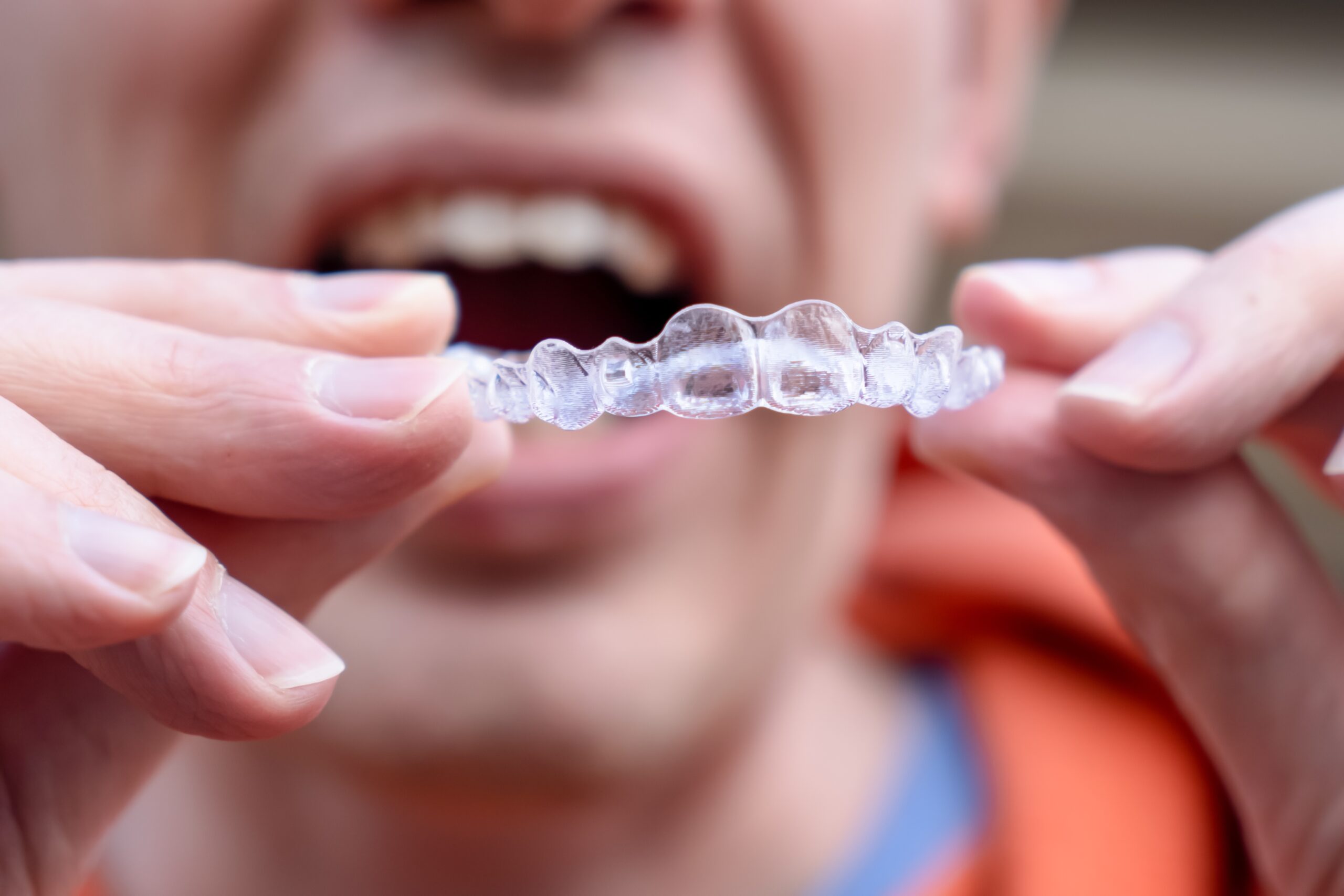 Is Invisalign Right for You? A Complete Guide for Fitchburg, MA Residents