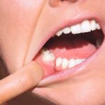 Options for Replacing Missing Teeth