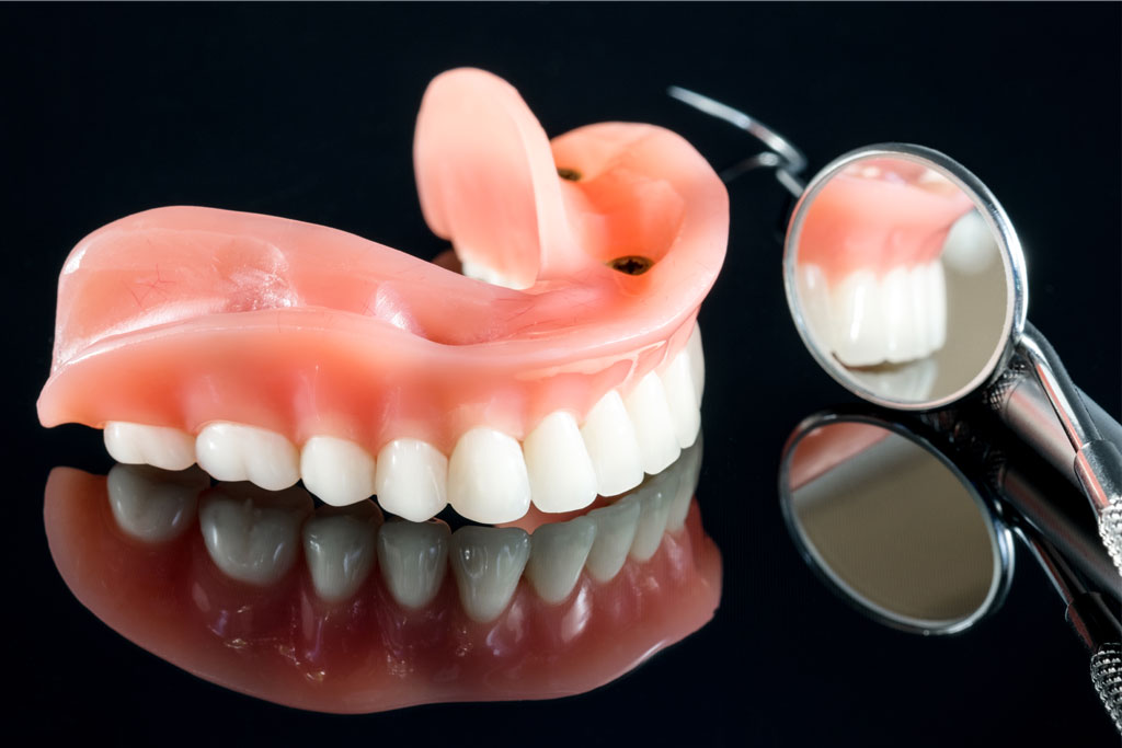 Complete Dentures