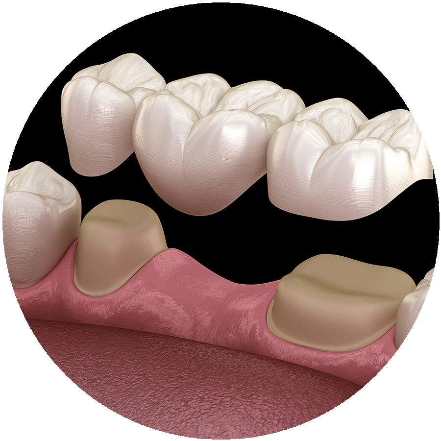 Restorative Dentistry